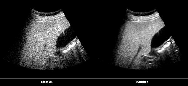 �����g�F�Ӱ���|�������߰�ȫ��3D/4D��δ��