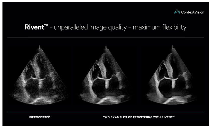 ��̩��Ӱ��ContextVision���l������ߴ�2D���D������ܛ��Rivent�����¶��x���D����������