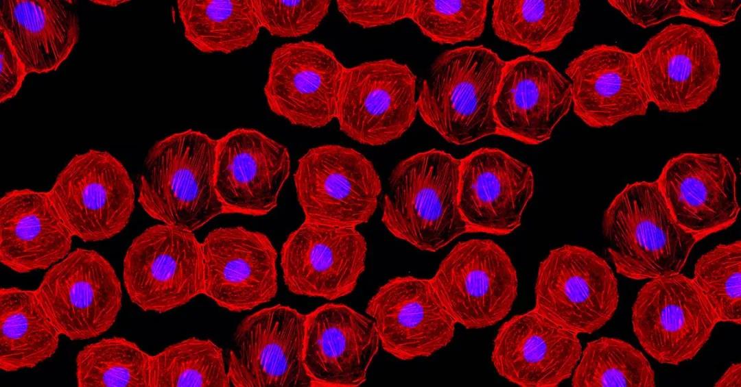 �������t�W�����У�CMOS���ɞ�sCMOS��������ƽ�r���