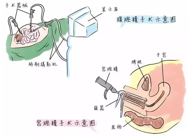 ���w������������΢�����g�O���еđ���