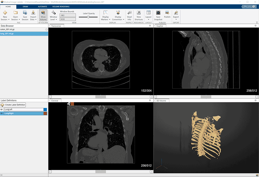 MATLAB��Simulink R2022b�ṩȫ�µ�Simscape Battery�Լ���������(ji��n)�����Ԅ�(d��ng)������ģ�͵��O(sh��)Ӌ(j��)